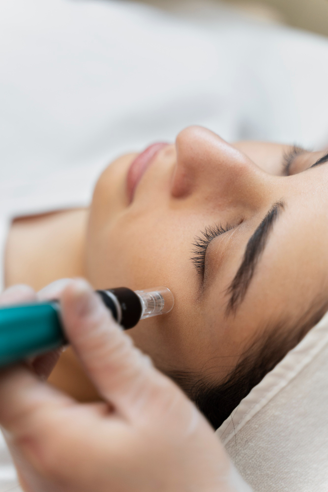 Microagujas Facial