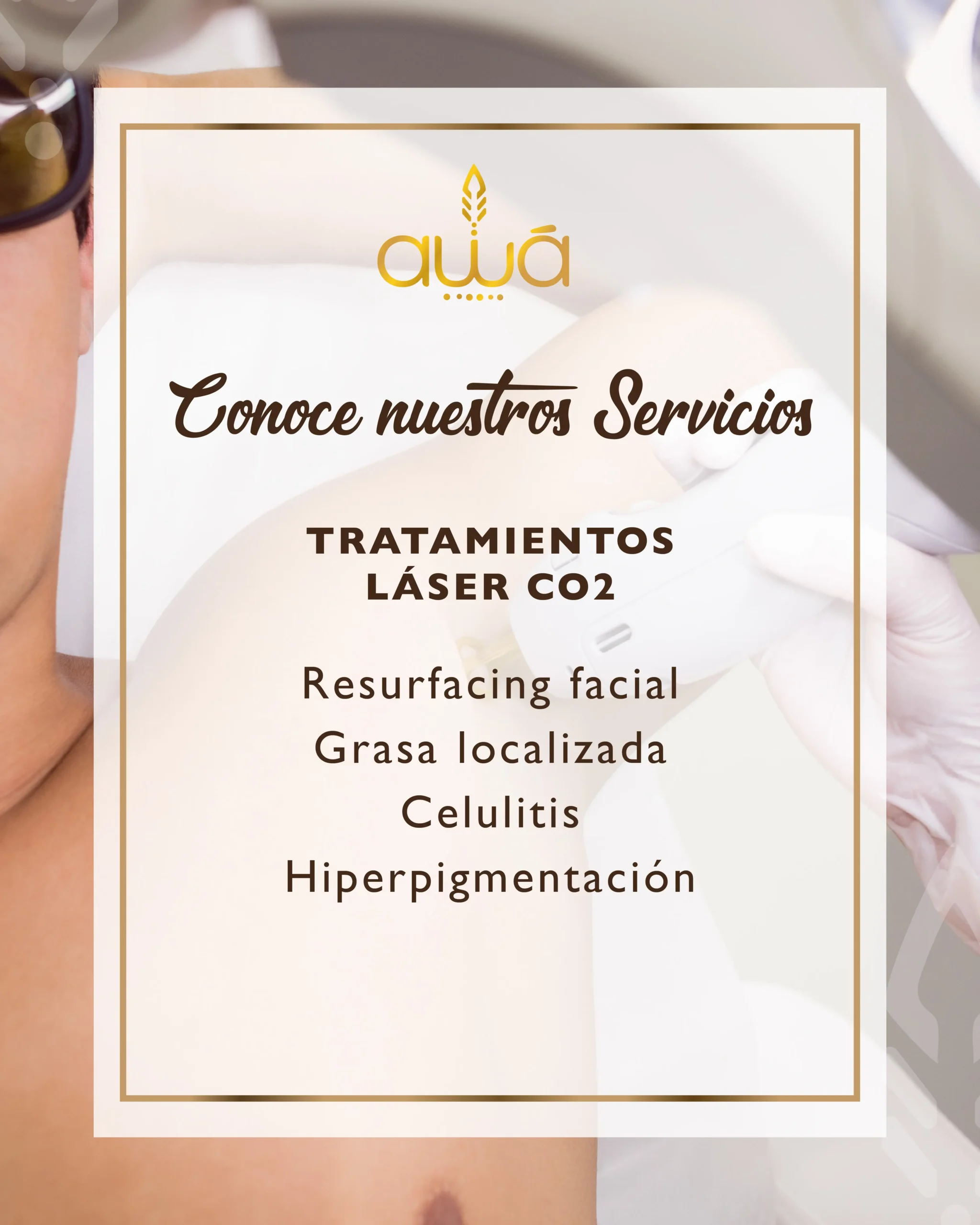 laser